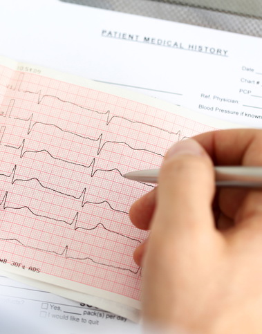 Malattie cardiovascolari, i programmi inglesi di check-up della salute riducono i fattori di rischio 